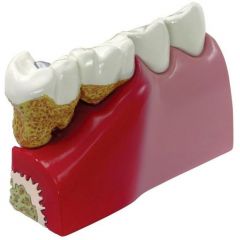 Zahnmodell, 3B Scientific (1019539)