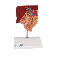 Gallensteinmodell - 3B Smart Anatomy, 3B Scientific (1000314 [K26])