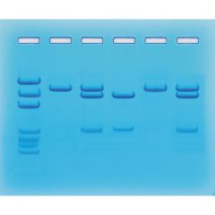 COVID-19 Testung mittels PCR