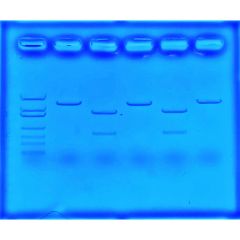 Behandlung von Mukoviszidose mit CRISPR