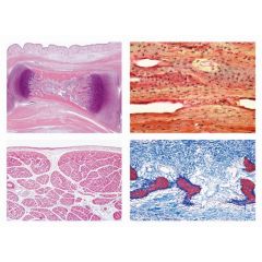 LIEDER Histologie und Menschenkunde, Einzeldarstellungen I, Deck- und Stützgewebe, Bewegungssystem, 15 Mikropräparate (L 70100)