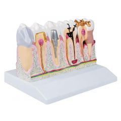 Dentalmodell, 4-fache Größe - EZ Augmented Anatomy, Erler & Zimmer (EZ D250)