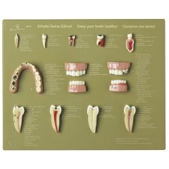 Schaukasten "Erhalte Deine Zähne", von SOMSO® (ES 6), Zähne in natürlicher Größe und zum Teil vergrößert dargestellt anhand von 12 Modellen, aus SOMSO-Plast®