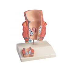 Hämorrhoidenmodell, 2-fache Größe, auf Stativ, Erler & Zimmer (EZ K227)