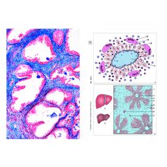 LIEDER Multimediapaket Schüler: Krankheiten des Menschen (Pathologie) Basissatz von 6 Einheiten (LIEDER SSD-12)