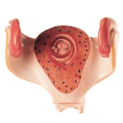 Uterus mit Embryo im 1. Monat, natürliche Größe, von SOMSO® (MS 12/1), unzerlegbar, aus SOMSO-Plast®