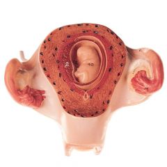 Uterus mit Embryo im 2. Monat, natürliche Größe, von SOMSO® (MS 12/2), unzerlegbar, aus SOMSO-Plast®