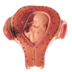 Uterus mit Embryo im 3. Monat, natürliche Größe, von SOMSO® (MS 12/3), unzerlegbar, aus SOMSO-Plast®