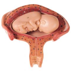 Uterus mit Embryo im 4.bis 5. Monat, natürliche Größe, Fetus in Bauchlage, von SOMSO® (MS 12/4), 2teilig, aus SOMSO-Plast®