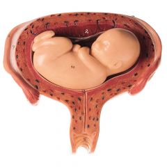 Uterus mit Embryo im 5. Monat, natürliche Größe, Fetus in Rückenlage, von SOMSO® (MS 12/6), 2teilig, aus SOMSO-Plast®