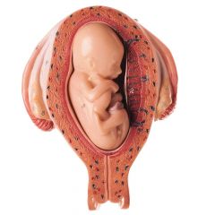 Uterus mit Embryo im 5. Monat, natürliche Größe, Fetus in Steißlage, von SOMSO® (MS 12/5), 2teilig, aus SOMSO-Plast®