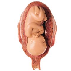 Uterus mit Embryo im 7. Monat, natürliche Größe, Fetus in Normallage, von SOMSO® (MS 12/7), 2teilig, aus SOMSO-Plast®