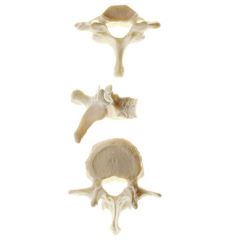 Wirbel (Vertebra), von SOMSO® (QS 17), nach der Natur modelliert, aus SOMSO-Plast®