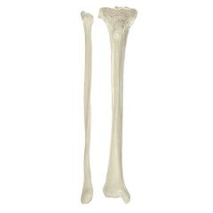 Unterschenkelknochen (Tibia et Fibula), von SOMSO® (QS 19/4), nach der Natur modelliert, aus SOMSO-Plast®