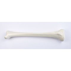 Schienbein (Tibia), von SOMSO® (QS 19/5), nach der Natur modelliert, aus SOMSO-Plast®