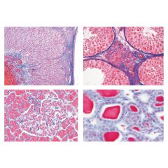 LIEDER Serie für die Sekundarstufe II, Serie IV. Hormone, Hormonfunktion, 7 Mikropräparate Art. 4470