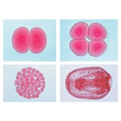 LIEDER Serie, Botanik, Zellenlehre und Embryologie, Entwicklung des Seeigels (Psammechinus miliaris), 12 ausgewählte Mikropräparate, mit bebilderten Begleittext LIEDER Art. 5200 www.laborplan.eu