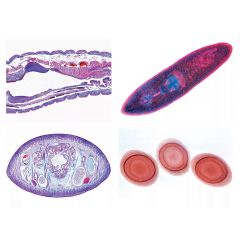 LIEDER Zoologie, Einzeldarstellungen, Würmer (Helminthes), 20 Mikropräparate (L 74500)