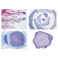 Mikropräpareteserie Moospflanzen (Bryophyta), 15 Präparate 78900 www.laborplan.eu
